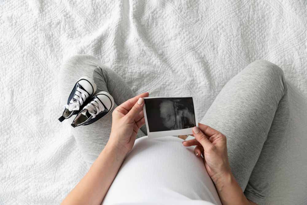 Vue de dessus d'une femme enceinte tenant une photo d'échographie.